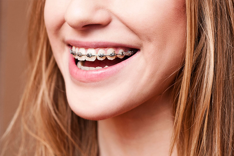 Orthodontics in La Puente